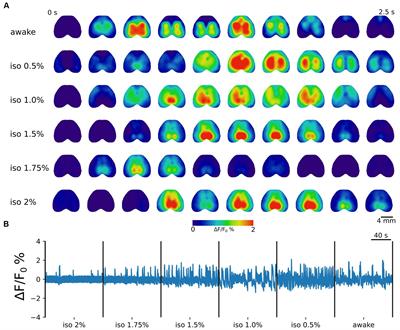Group ICA of wide-field calcium imaging data reveals the retrosplenial cortex as a major contributor to cortical activity during anesthesia